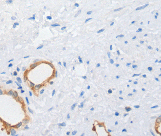Anti-Human MUC5AC Antibody - ABMIUM