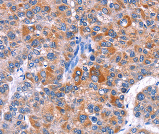 Anti-Human/Rat ELP2 Antibody - ABMIUM