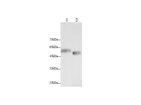 Anti-Mouse/Rat PDK4 Antibody - ABMIUM