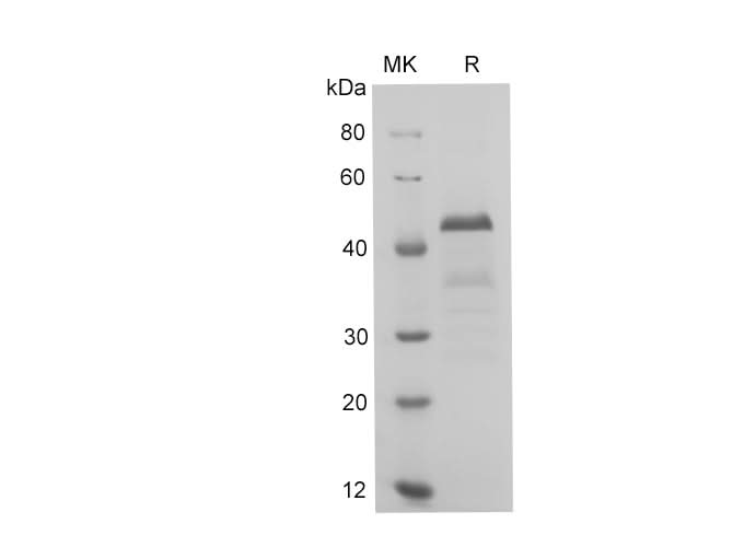 SDS-PAGE analysis of Human THP proteins, 2 μg/lane of Recombinant Human THP proteins was resolved with SDS-PAGE under reducing conditions, showing bands at 50 kDa.