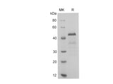 SDS-PAGE analysis of Human THP proteins, 2 μg/lane of Recombinant Human THP proteins was resolved with SDS-PAGE under reducing conditions, showing bands at 50 kDa.