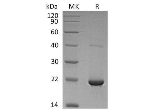 Recombinant Human dUTPase Protein (His Tag) - ABMIUM