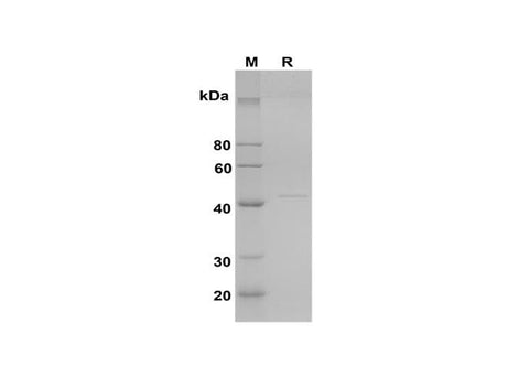 SDS-PAGE analysis of Rat AST proteins, 2 μg/lane of Recombinant Rat AST proteins was resolved with SDS-PAGE under reducing conditions, showing bands at 44 kDa.