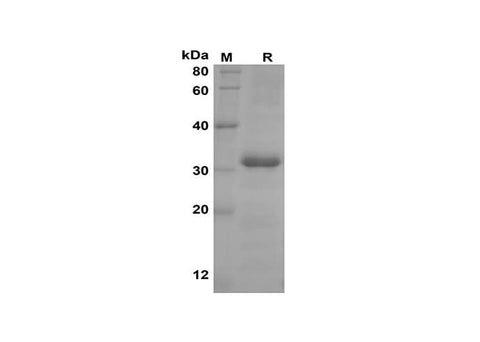 SDS-PAGE analysis of Human CXCL4/CXCL4/PF4 proteins, 2 μg/lane of Recombinant Human CXCL4/CXCL4/PF4 proteins was resolved with SDS-PAGE under reducing conditions, showing bands at 32 kDa.