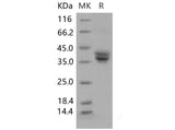 Recombinant Mouse GPA33/Glycoprotein A33 Protein (His Tag) - ABMIUM