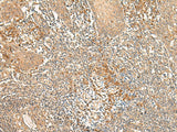 Immunohistochemistry of paraffin-embedded Human tonsil tissue using WLS Polyclonal Antibody at dilution of 1:50(×200)