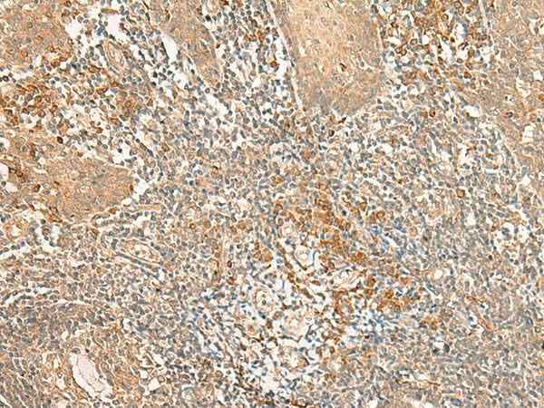 Anti-Human/Mouse/Rat WLS Antibody