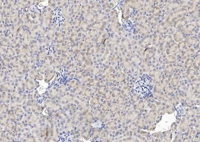 Anti-Mouse EPO Antibody [B506] - ABMIUM