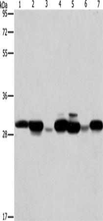Anti-Human/Mouse/Rat AK2 Antibody - ABMIUM