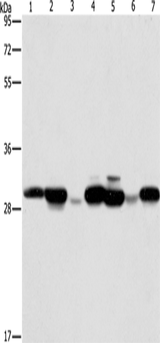 Anti-Human/Mouse/Rat AK2 Antibody - ABMIUM