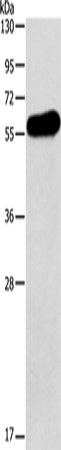 Anti-Human APOH Antibody - ABMIUM