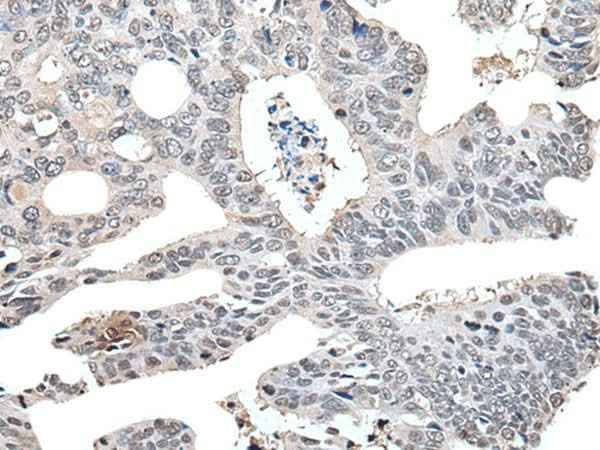 Anti-Human/Mouse/Rat TCEB2 Antibody