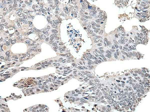 Anti-Human/Mouse/Rat TCEB2 Antibody