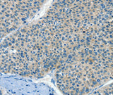 Anti-Human/Mouse HID1 Antibody - ABMIUM