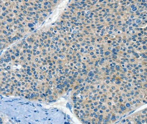 Anti-Human/Mouse HID1 Antibody - ABMIUM
