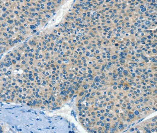 Anti-Human/Mouse HID1 Antibody - ABMIUM