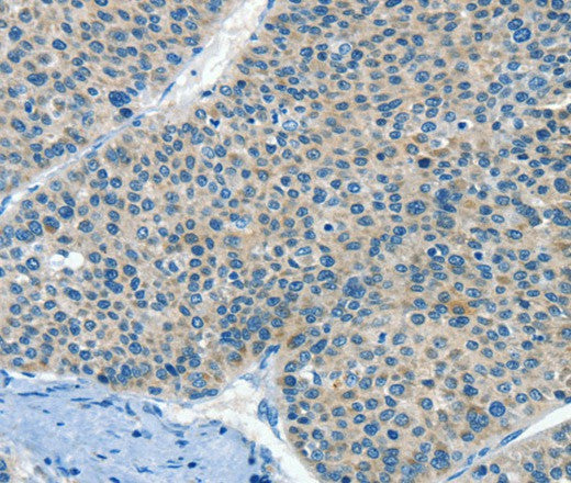 Anti-Human/Mouse HID1 Antibody - ABMIUM