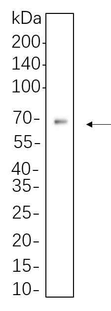 Anti-Human/Mouse/Rat AFP Antibody [B1081] - ABMIUM