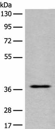 Anti-Human/Mouse EN2 Antibody - ABMIUM