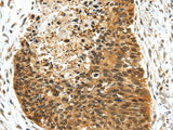 Anti-Human/Mouse/Rat NR2F2 Antibody - ABMIUM