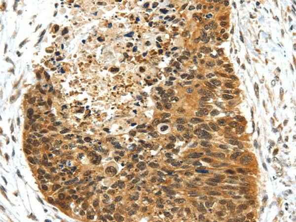 Anti-Human/Mouse/Rat NR2F2 Antibody