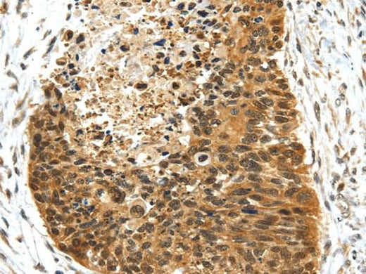 Anti-Human/Mouse/Rat NR2F2 Antibody - ABMIUM