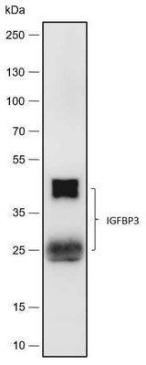 Anti-Human IGFBP3 Antibody [A496]