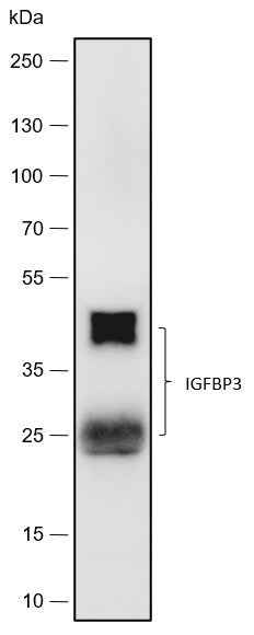 Anti-Human IGFBP3 Antibody [A496] - ABMIUM
