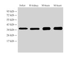 Western Blot analysis of 1)Jurkat, 2)Rat kidney, 3)Mouse brain, 4)Mouse heart using LDHB Ployclonal Antibody at dilution of 1:1000.