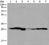 Western blot analysis of Human kidney tissue RAW264.7 cell Mouse kidney tissue Human lung tissue Human fetal liver tissue Hela and 231 cell lysates using VTI1B Polyclonal Antibody at dilution of 1:300