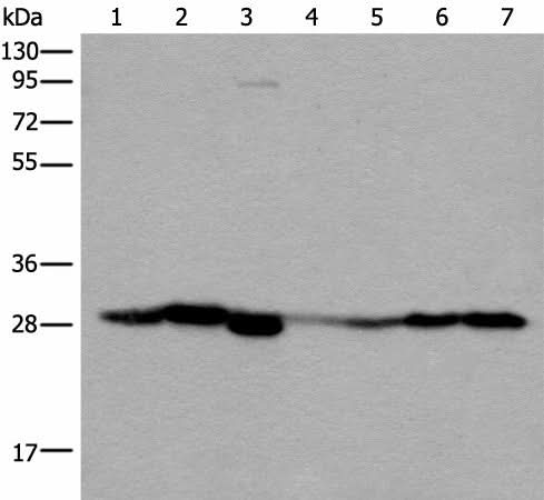 Western blot analysis of Human kidney tissue RAW264.7 cell Mouse kidney tissue Human lung tissue Human fetal liver tissue Hela and 231 cell lysates using VTI1B Polyclonal Antibody at dilution of 1:300