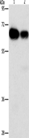 Anti-Human ARHGEF5 Antibody - ABMIUM