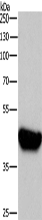 Anti-Human/Mouse/Rat BABAM2 Antibody - ABMIUM