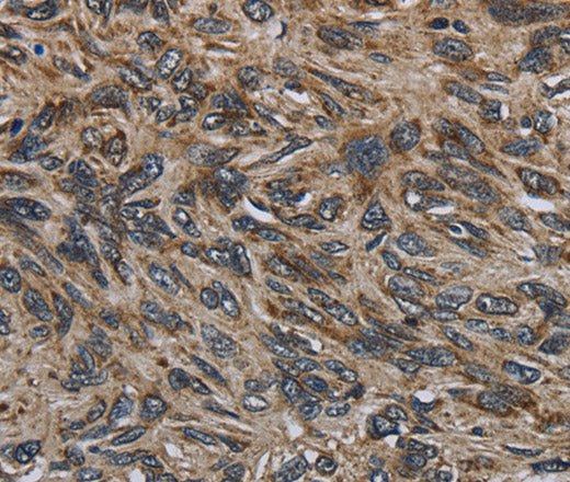 Anti-Human GYPC Antibody - ABMIUM