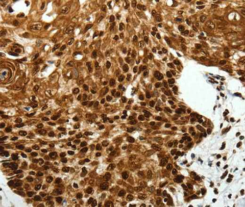 Anti-Human/Rat SCN1A Antibody