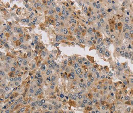 Anti-Human KIF17 Antibody