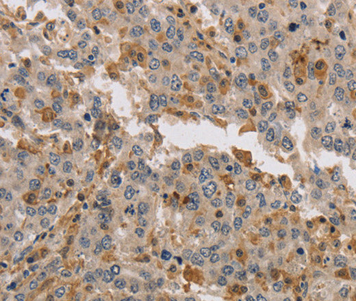 Anti-Human KIF17 Antibody - ABMIUM