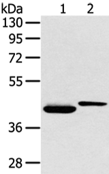 Anti-Human/Mouse/Rat BMP4 Antibody - ABMIUM