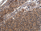 Anti-Human RAB41 Antibody - ABMIUM