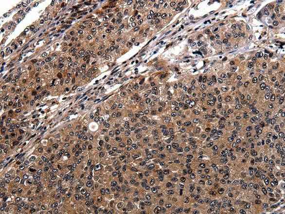 Anti-Human RAB41 Antibody