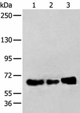 Western blot analysis of TM4 K562 and A431 cell lysates using ZBTB5 Polyclonal Antibody at dilution of 1:250
