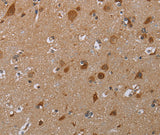 Anti-Human MARK1 Antibody - ABMIUM