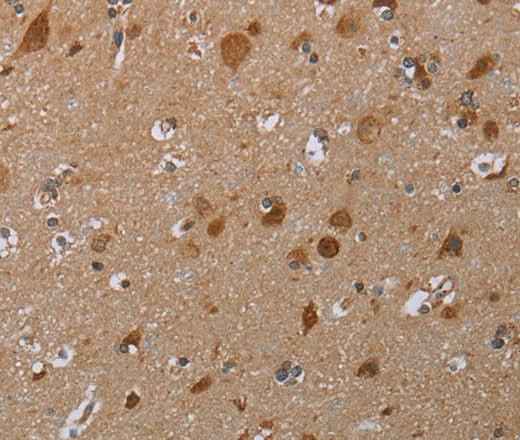 Anti-Human MARK1 Antibody