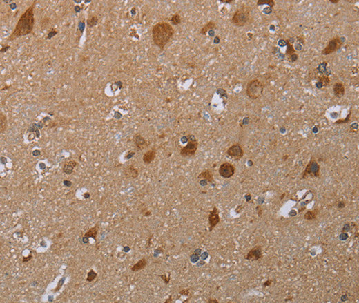 Anti-Human MARK1 Antibody - ABMIUM