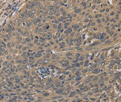 Anti-Human/Mouse HSF1 Antibody