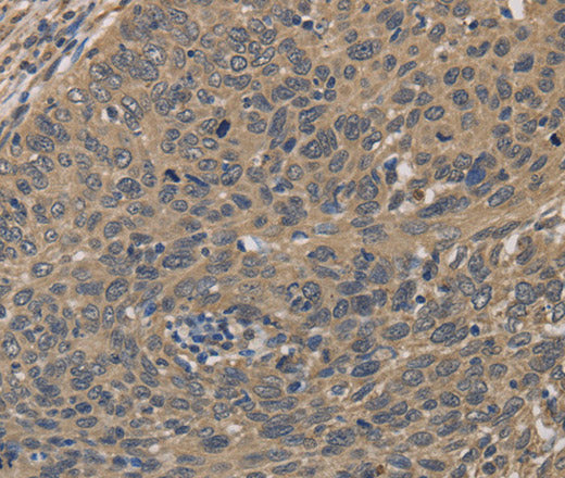 Anti-Human/Mouse HSF1 Antibody - ABMIUM