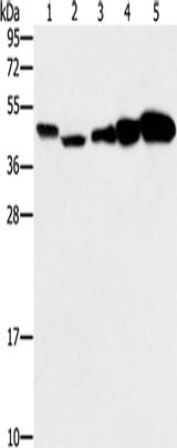 Anti-Human/Mouse/Rat PPAT Antibody - ABMIUM
