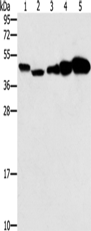 Anti-Human/Mouse/Rat PPAT Antibody - ABMIUM