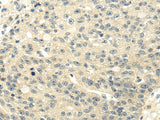 Anti-Human/Mouse/Rat GAD1 Antibody - ABMIUM