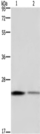 Anti-Human/Mouse/Rat EMC8 Antibody - ABMIUM